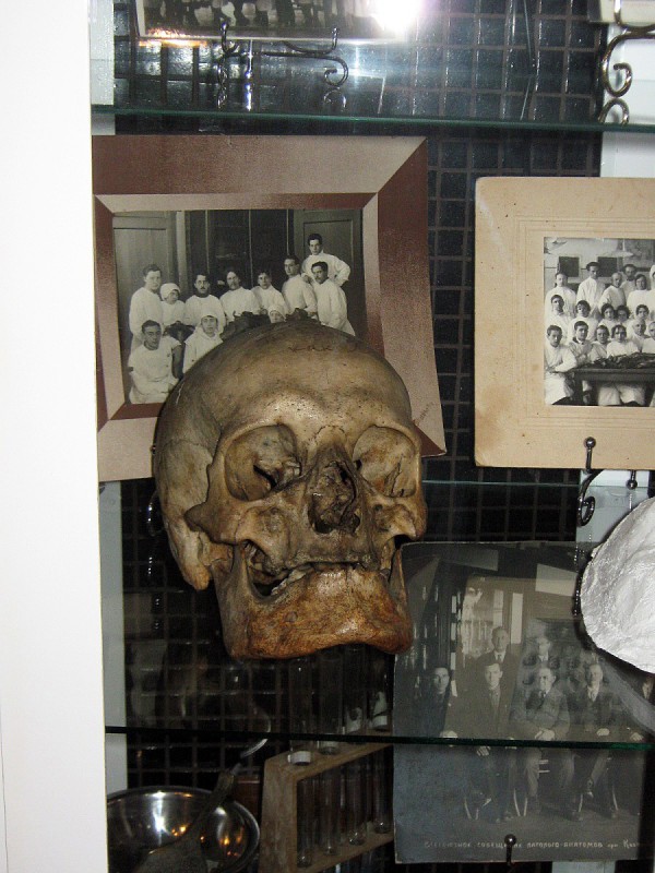 Человеческий череп – экспонат музея © Алёна Груя